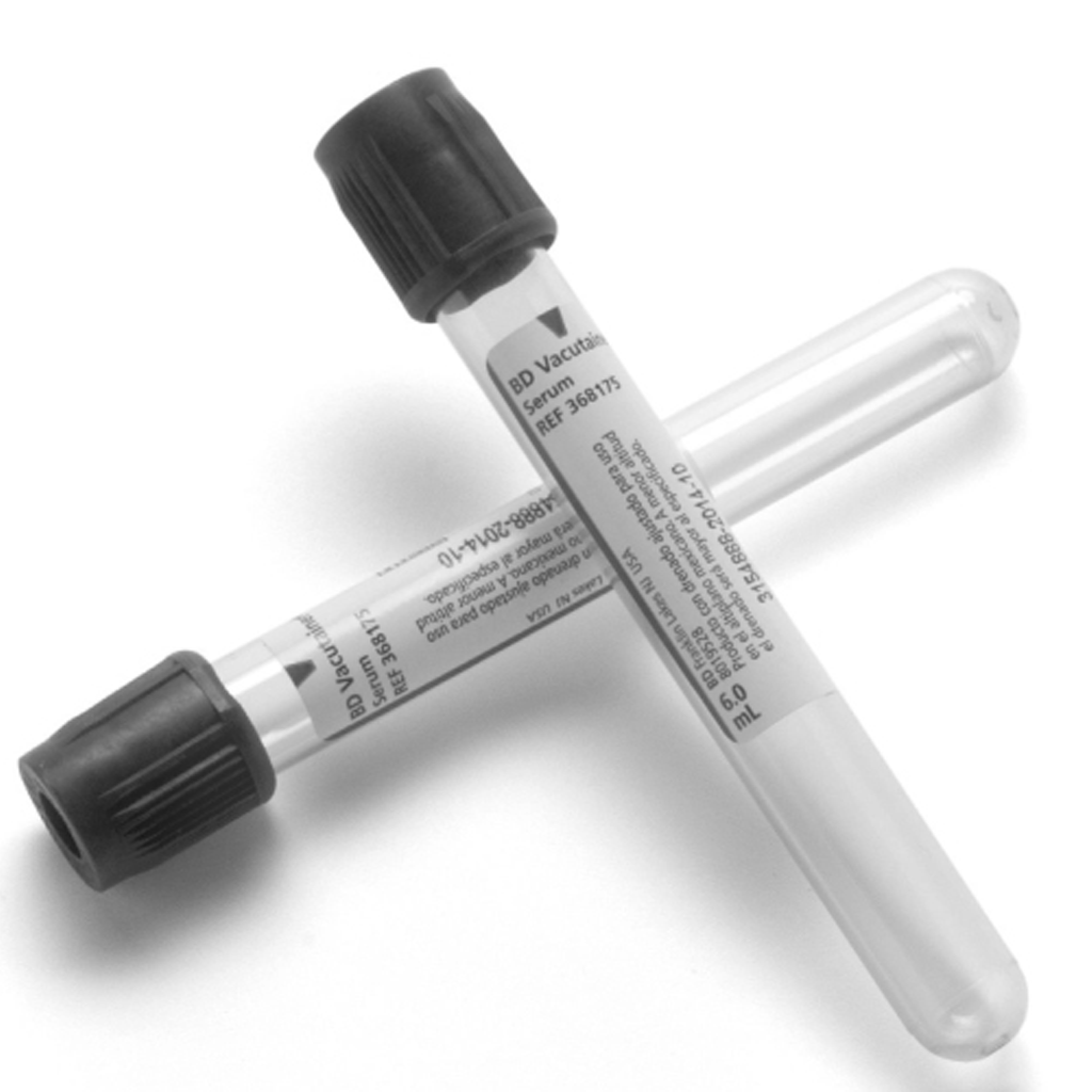 HORMONA PARATIROIDEA (PARATHORMONA/PTH-Intacta)