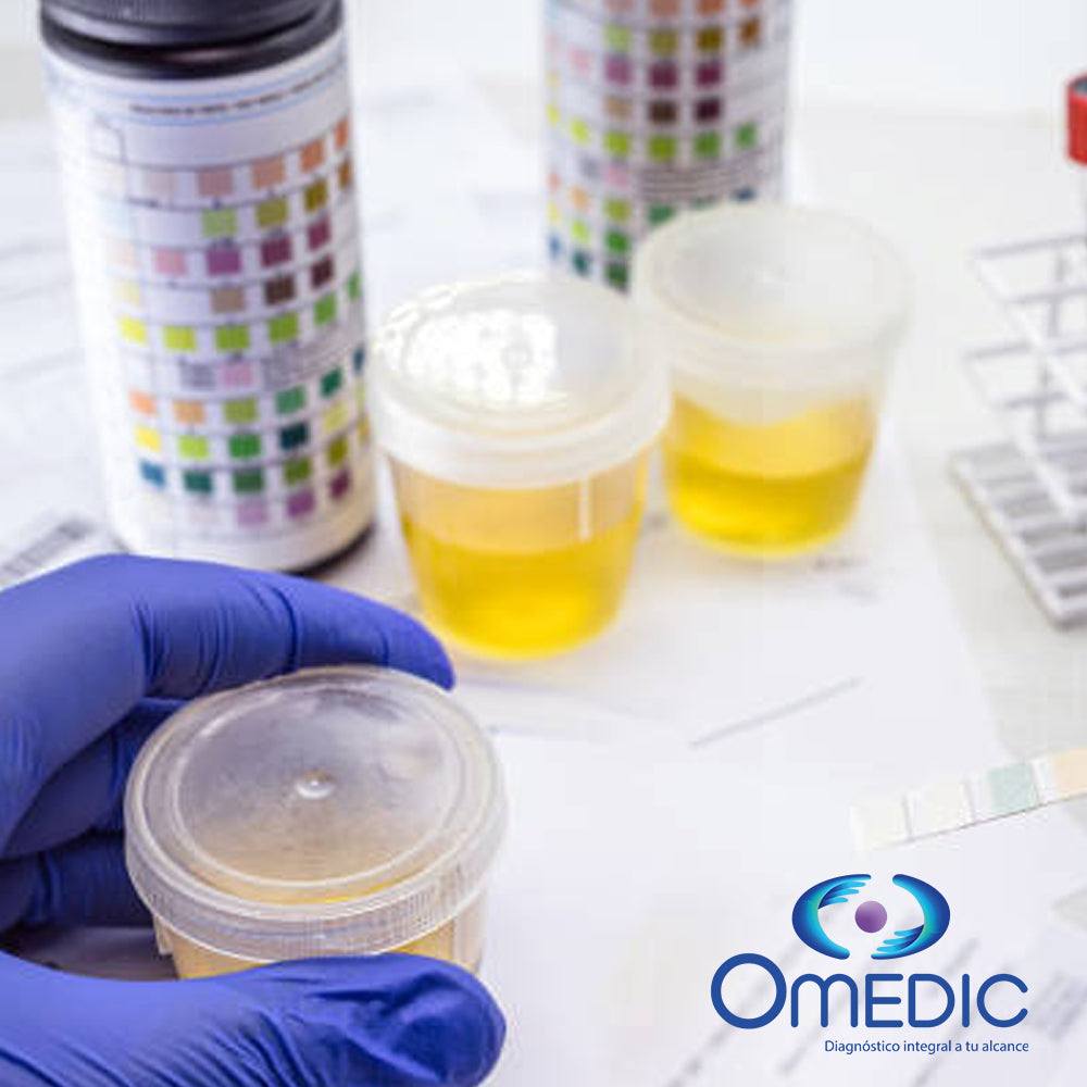 Urine drug test containers with color test strips for detecting cocaine, methamphetamine, amphetamines, benzodiazepines, and opiates.