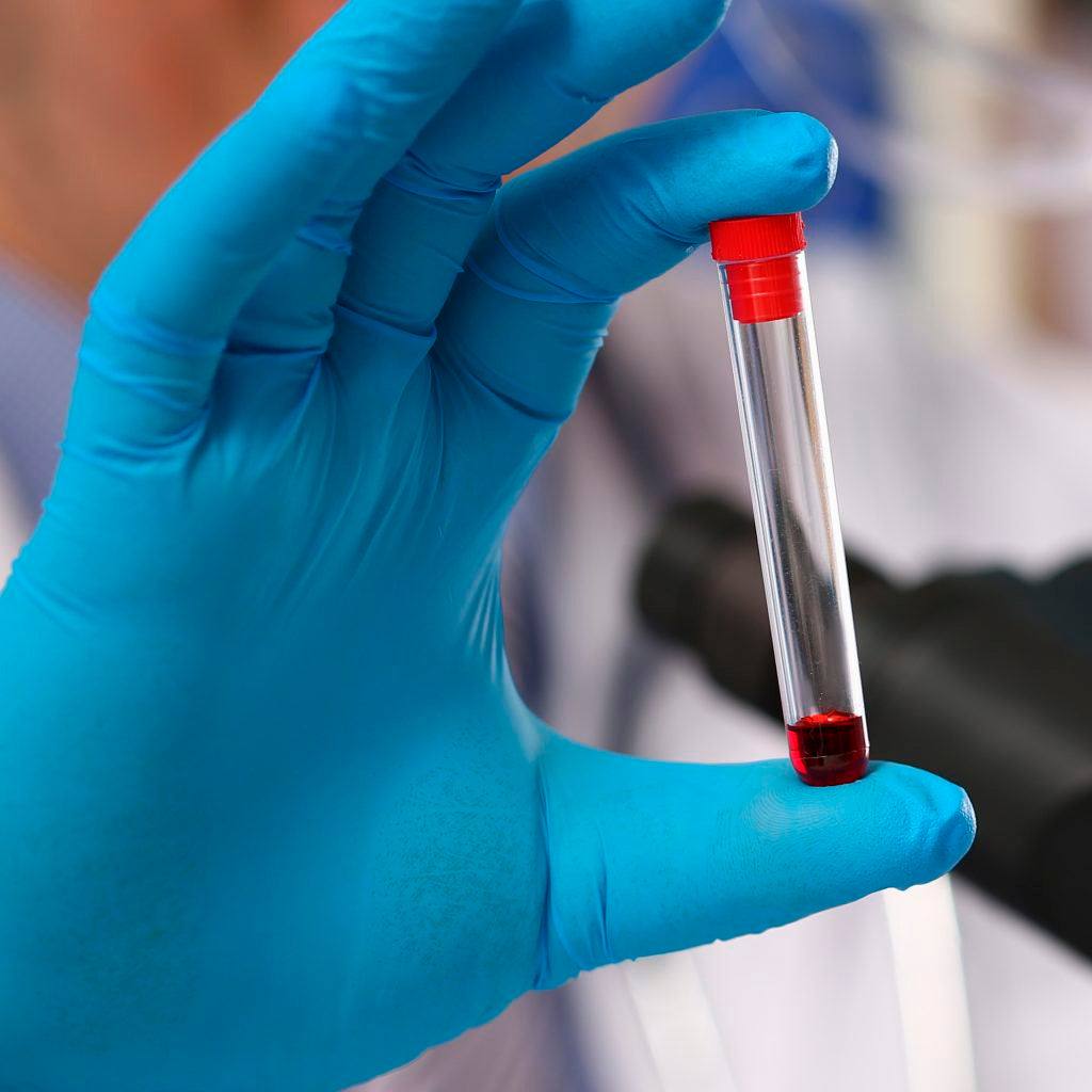 Gloved hand holding a test tube with blood for electrolitos séricos serum electrolyte panel analysis