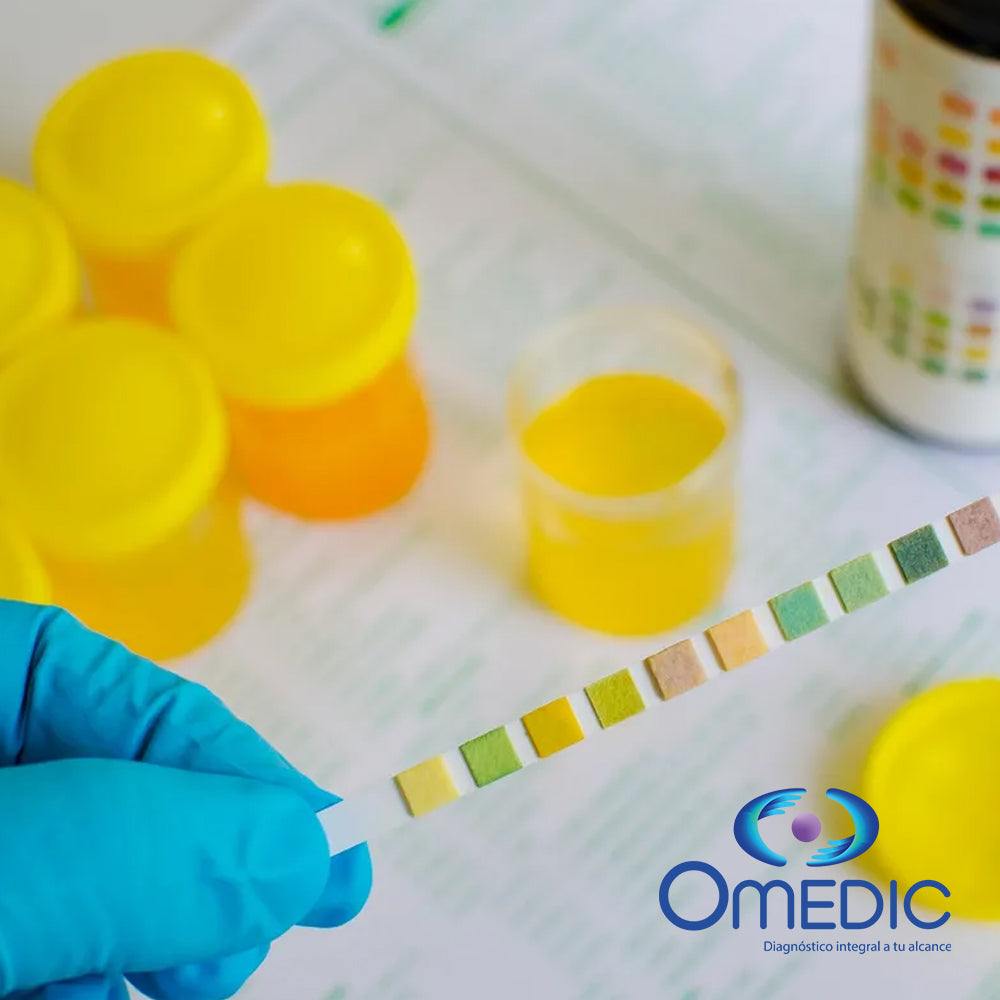 El Examen General de Orina (EGO) es una prueba médica que permite analizar diversos componentes de la orina para evaluar la salud renal y detectar posibles infecciones