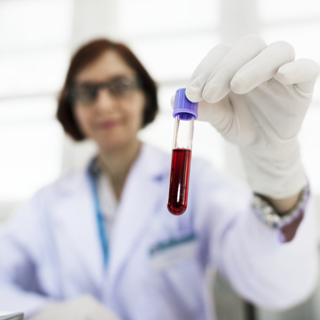 Scientist holding a blood sample tube for basal insulin test measuring insulin concentration after fasting.