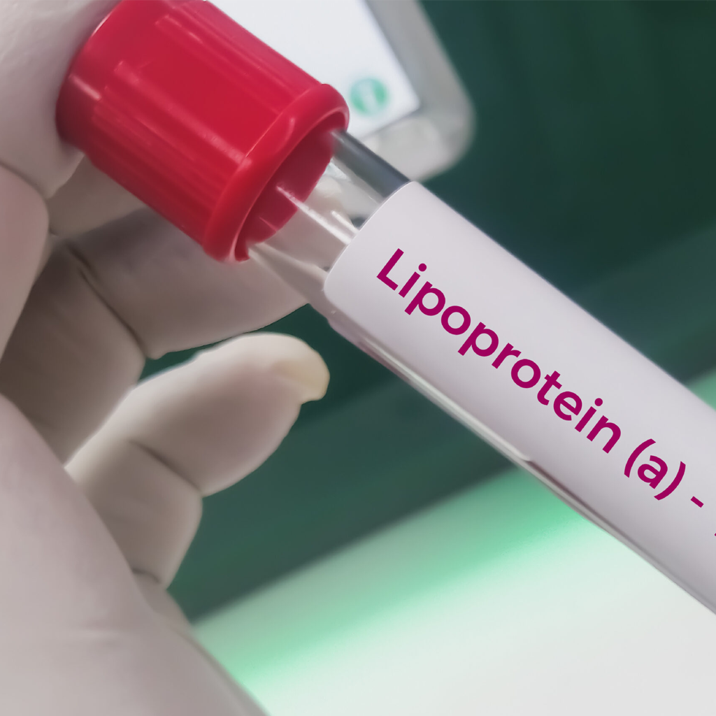 Close-up of a blood sample tube labeled Lipoprotein (a) test for cardiovascular risk analysis