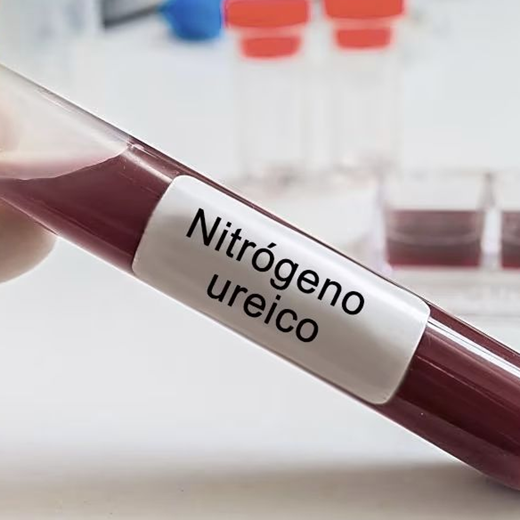 Blood sample tube labeled Nitrógeno ureico for kidney function test.