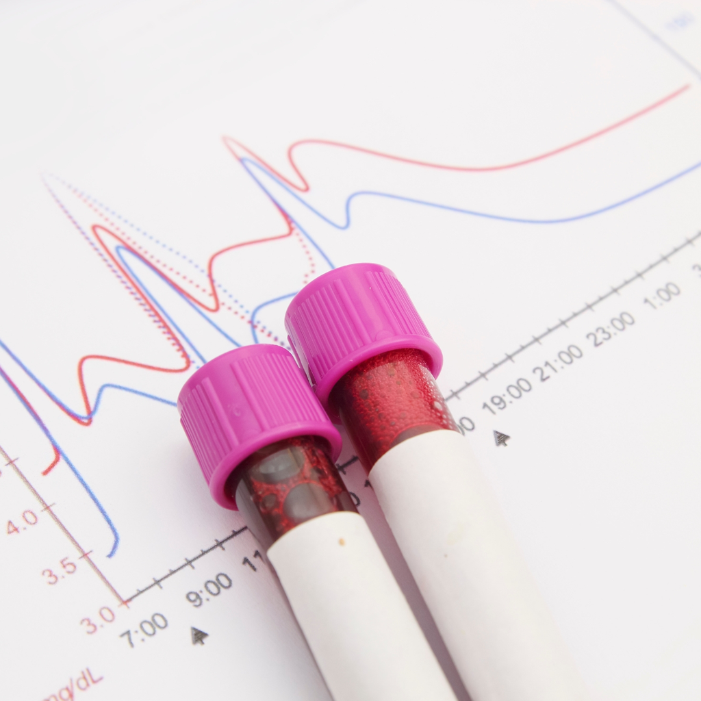 Blood test tubes with purple caps on a biochemical graph for PERFIL CINÉTICA DE HIERRO iron kinetics analysis
