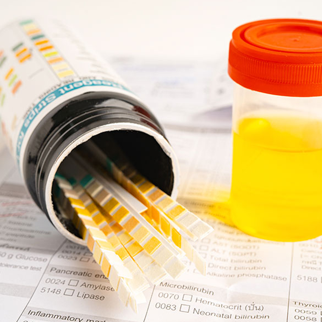 Urine drug test strips and sample container for perfil de drogas abuse screening.