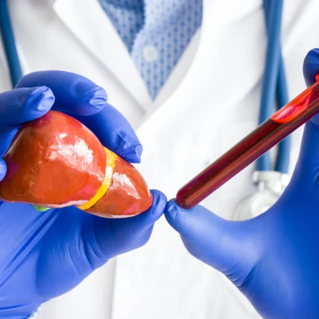 Doctor holding liver model and blood sample for pruebas de función hepática test