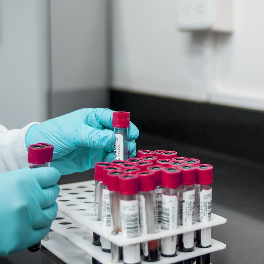 Medical laboratory technician handling blood sample tubes with red caps for chemical blood analysis Química Sanguínea 12 elementos.