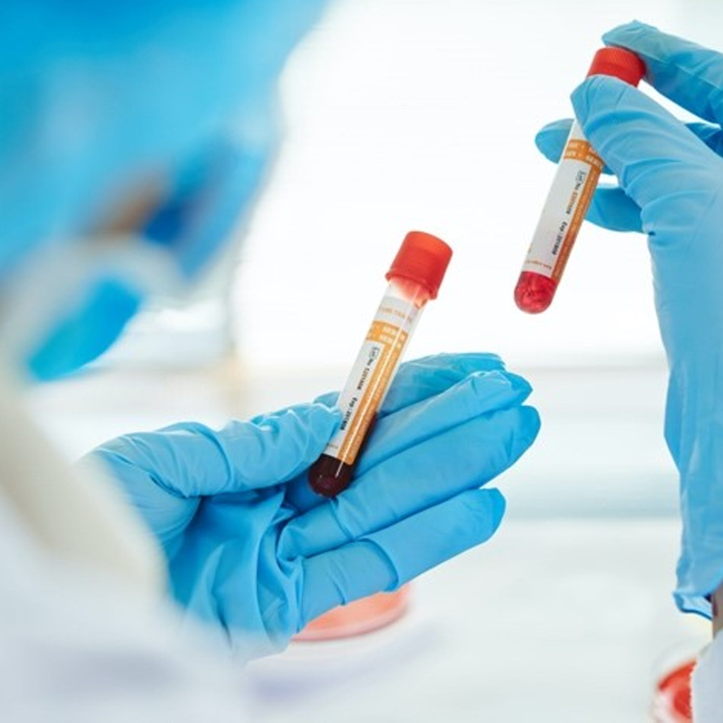 Laboratory technician holding blood sample vials for QUÍMICA SANGUÍNEA 24 ELEMENTOS-Omedic blood chemistry analysis
