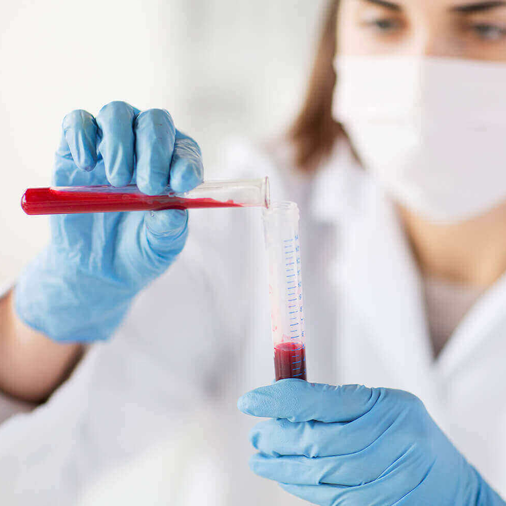 Laboratory technician handling blood sample test tubes for Química Sanguínea 3 Elementos analysis