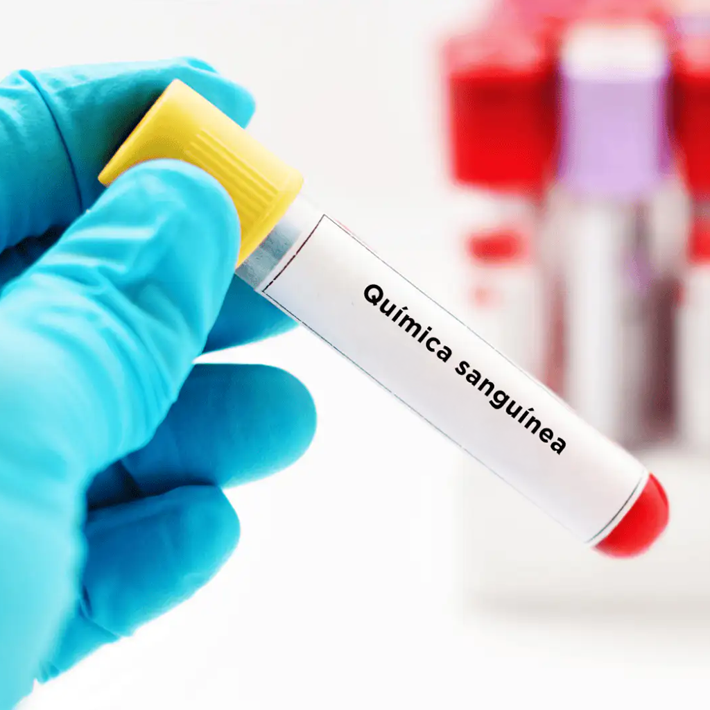 Blood sample vial labeled Química sanguínea held by gloved hand for 44-element blood chemistry analysis