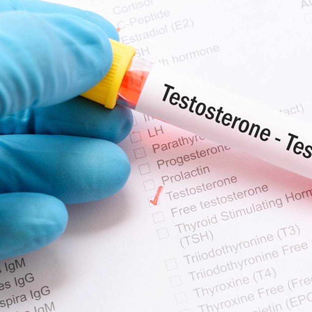 Gloved hand holding testosterone test tube over hormone test checklist for total testosterone measurement
