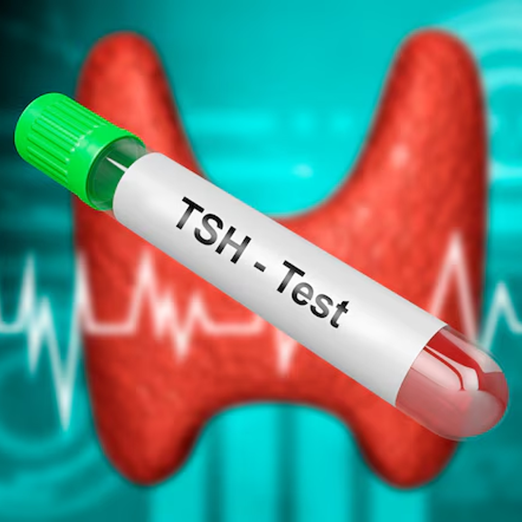 Blood sample vial labeled TSH test for thyroid stimulating hormone measurement