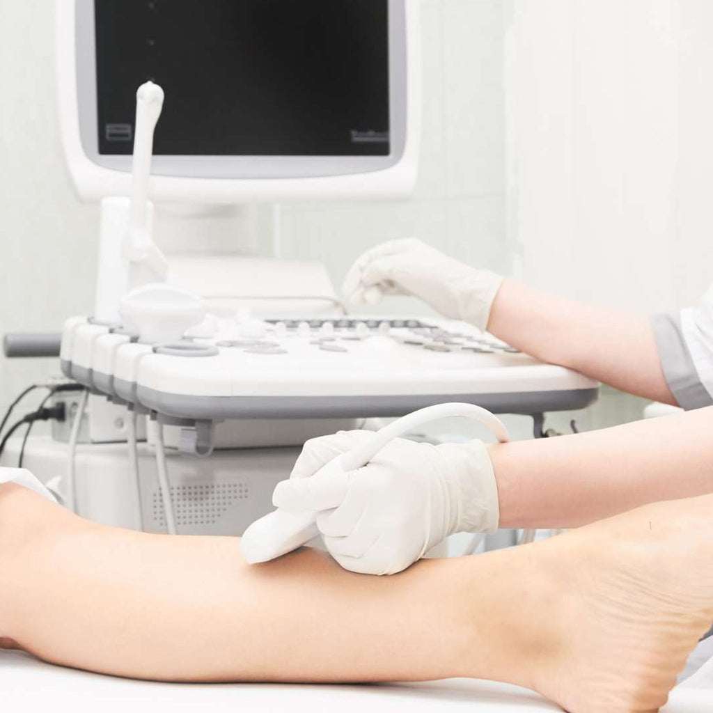 Ultrasonido doppler iliofemoral examinating blood flow in leg arteries and veins with medical ultrasound device