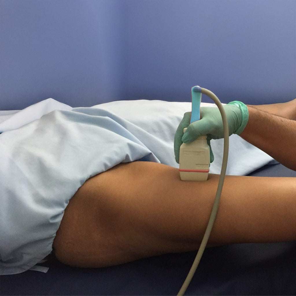 Ultrasonido Doppler venoso en miembro pélvico para detectar coágulos de sangre, procedimiento seguro sin radiación.