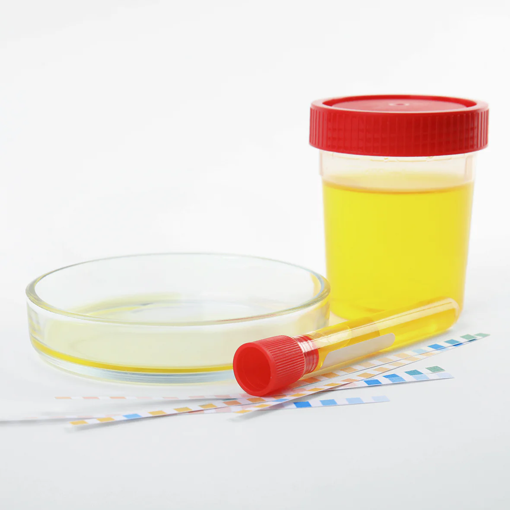 Urine sample container with test tubes and pH strips for UROCULTIVO bacterial infection analysis
