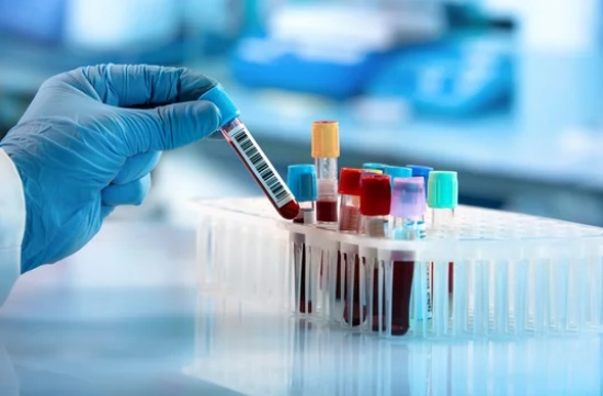 El índice HOMA (Homeostasis Model Assessment) es una herramienta utilizada para medir la resistencia a la insulina y la función de las células beta del páncreas. Se 