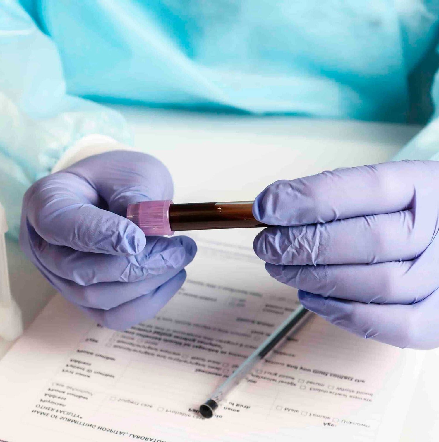 Biometría Hemática blood test components and preparation details information chart